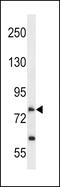 Sodium/nucleoside cotransporter 2 antibody, 58-314, ProSci, Western Blot image 