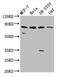 Oligophrenin-4 antibody, CSB-PA011624LA01HU, Cusabio, Western Blot image 