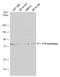 CTP Synthase 1 antibody, GTX105265, GeneTex, Western Blot image 