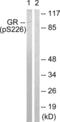 Nuclear Receptor Subfamily 3 Group C Member 1 antibody, abx012430, Abbexa, Western Blot image 