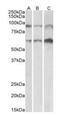 ADAM Metallopeptidase Domain 12 antibody, orb176700, Biorbyt, Western Blot image 