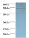 Cyclin Dependent Kinase 11A antibody, LS-C211751, Lifespan Biosciences, Western Blot image 