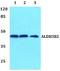 Aldehyde Dehydrogenase 3 Family Member B2 antibody, A05723, Boster Biological Technology, Western Blot image 