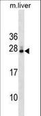 DnaJ Heat Shock Protein Family (Hsp40) Member B9 antibody, LS-C159473, Lifespan Biosciences, Western Blot image 