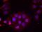 Estrogen Receptor 1 antibody, GTX50139, GeneTex, Immunocytochemistry image 