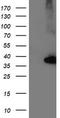 Nudix Hydrolase 18 antibody, TA503864S, Origene, Western Blot image 