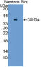 Neuregulin 4 antibody, LS-C314907, Lifespan Biosciences, Western Blot image 