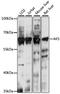 Adenylate Kinase 5 antibody, LS-C750397, Lifespan Biosciences, Western Blot image 