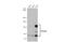 Palladin, Cytoskeletal Associated Protein antibody, GTX135128, GeneTex, Western Blot image 