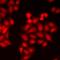 Protein Tyrosine Kinase 6 antibody, orb412622, Biorbyt, Immunocytochemistry image 