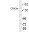 Glycoprotein Ib Platelet Subunit Alpha antibody, LS-C199800, Lifespan Biosciences, Western Blot image 