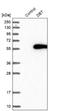 Dihydrolipoamide Branched Chain Transacylase E2 antibody, NBP1-85963, Novus Biologicals, Western Blot image 