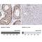 BCL2 Associated Athanogene 6 antibody, NBP2-38693, Novus Biologicals, Immunohistochemistry paraffin image 