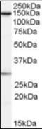 SPT16 Homolog, Facilitates Chromatin Remodeling Subunit antibody, orb89720, Biorbyt, Western Blot image 