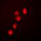 SWI/SNF Related, Matrix Associated, Actin Dependent Regulator Of Chromatin, Subfamily A, Member 4 antibody, abx142231, Abbexa, Western Blot image 