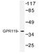G Protein-Coupled Receptor 119 antibody, AP01207PU-N, Origene, Western Blot image 