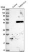 Transmembrane Protein 151A antibody, PA5-59405, Invitrogen Antibodies, Western Blot image 