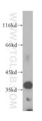 Mitochondrial Ribosome Associated GTPase 1 antibody, 13742-1-AP, Proteintech Group, Western Blot image 