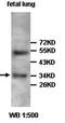 Sad1 And UNC84 Domain Containing 1 antibody, orb76818, Biorbyt, Western Blot image 