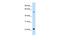 Solute Carrier Family 17 Member 5 antibody, PA5-42456, Invitrogen Antibodies, Western Blot image 