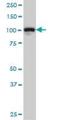 Progesterone Receptor antibody, H00005241-M07, Novus Biologicals, Western Blot image 