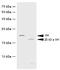 Growth Hormone 1 antibody, LS-B2974, Lifespan Biosciences, Western Blot image 