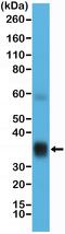 CD276 Molecule antibody, MA5-27897, Invitrogen Antibodies, Western Blot image 