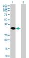 Ring Finger Protein 144A antibody, H00009781-B01P, Novus Biologicals, Western Blot image 