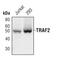 TNF receptor-associated factor 2 antibody, PA5-17500, Invitrogen Antibodies, Western Blot image 