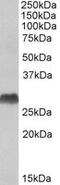 Major Histocompatibility Complex, Class II, DQ Alpha 2 antibody, MBS422472, MyBioSource, Western Blot image 