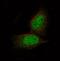 Preferentially Expressed Antigen In Melanoma antibody, NBP2-61148, Novus Biologicals, Immunocytochemistry image 