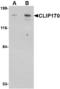 CAP-Gly Domain Containing Linker Protein 1 antibody, LS-C53324, Lifespan Biosciences, Western Blot image 