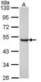 Presenilin 1 antibody, PA5-30585, Invitrogen Antibodies, Western Blot image 