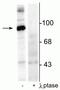 Dynamin-I antibody, P02536, Boster Biological Technology, Immunofluorescence image 