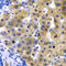 Low Density Lipoprotein Receptor Adaptor Protein 1 antibody, A7093, ABclonal Technology, Immunohistochemistry paraffin image 