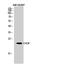 DNA Damage Inducible Transcript 3 antibody, STJ92276, St John