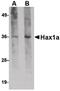 HCLS1 Associated Protein X-1 antibody, MA5-15769, Invitrogen Antibodies, Western Blot image 