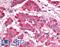 Pyruvate Dehydrogenase Kinase 1 antibody, LS-C141005, Lifespan Biosciences, Immunohistochemistry paraffin image 
