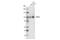 Glutamate Ionotropic Receptor AMPA Type Subunit 3 antibody, 4676T, Cell Signaling Technology, Western Blot image 