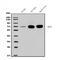 Neurofilament Light antibody, A02482-1, Boster Biological Technology, Western Blot image 