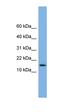 Sperm Autoantigenic Protein 17 antibody, orb325884, Biorbyt, Western Blot image 