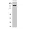 Adenylate Cyclase 1 antibody, LS-C381814, Lifespan Biosciences, Western Blot image 