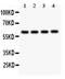 SYNCAM antibody, PB9136, Boster Biological Technology, Western Blot image 