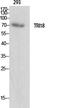 Midline 1 antibody, GTX34076, GeneTex, Western Blot image 