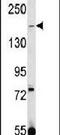 Transient Receptor Potential Cation Channel Subfamily M Member 7 antibody, PA5-15302, Invitrogen Antibodies, Western Blot image 