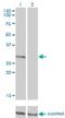 Fc Fragment Of IgE Receptor Ia antibody, H00002205-M01, Novus Biologicals, Western Blot image 