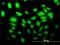 SLC2A4 Regulator antibody, H00056731-M02, Novus Biologicals, Immunocytochemistry image 