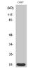 Stathmin 1 antibody, STJ94829, St John