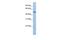 Lysyl Oxidase Like 1 antibody, GTX45382, GeneTex, Western Blot image 