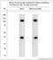 Transient Receptor Potential Cation Channel Subfamily C Member 4 antibody, LS-C829615, Lifespan Biosciences, Western Blot image 